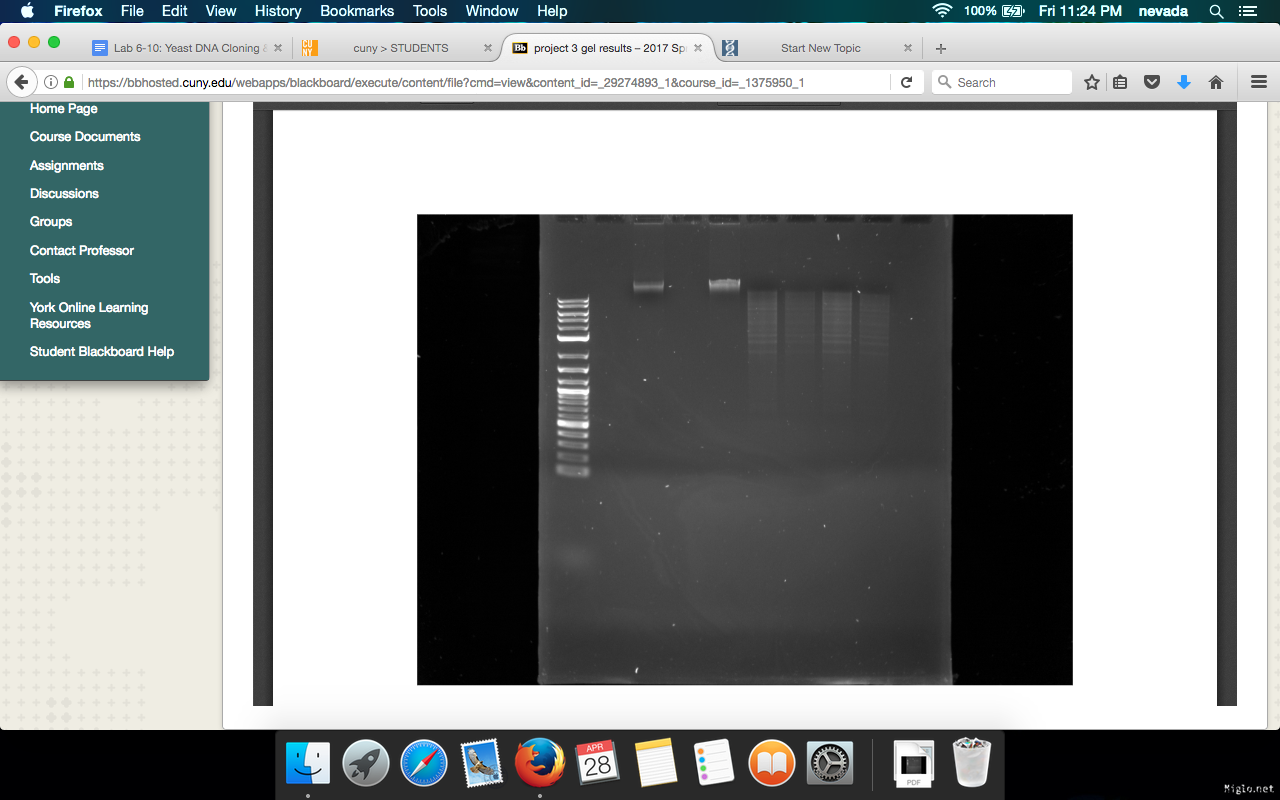 How to read gel electrophoresis result