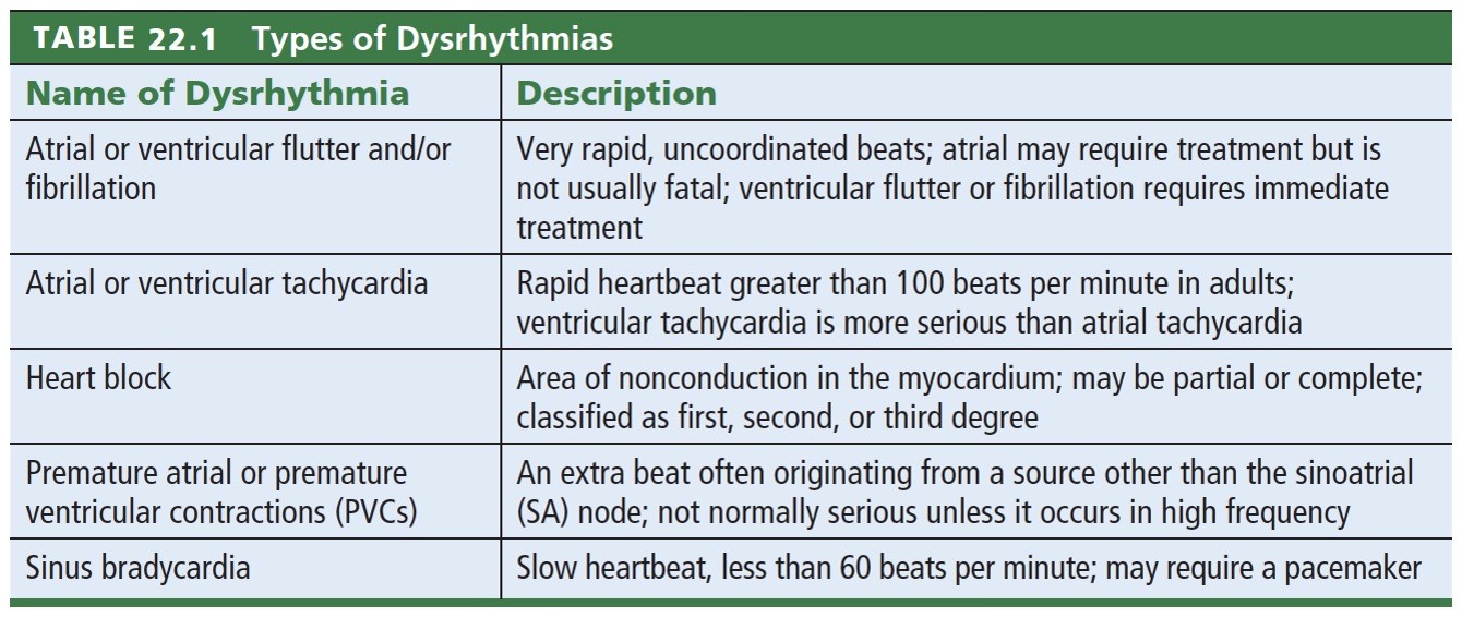 Types of Dysrhythmias 