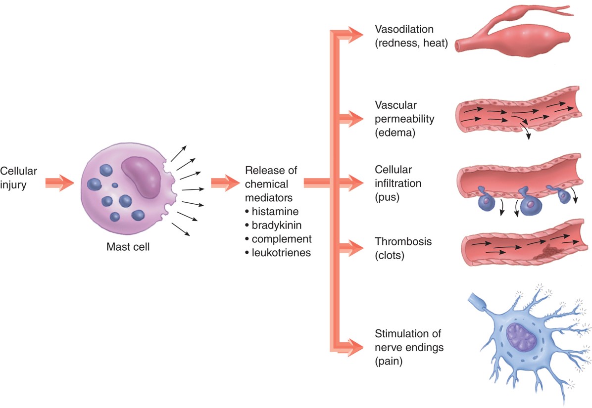 Steps in acute inflammation.