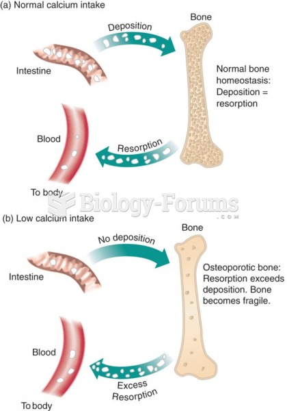 Calcium metabolism in osteoporosis: (a) bone deposition equals bone resorption; (b) bone resorption ...