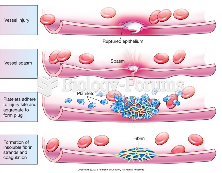 The basic steps in hemostasis.