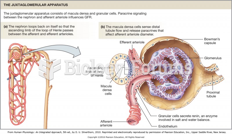 The macula densa and the juxtaglomerular (JG) cells. Osmoreceptors in the macula densa sense low ...