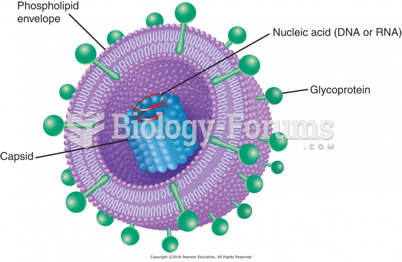 General structure of a virus.