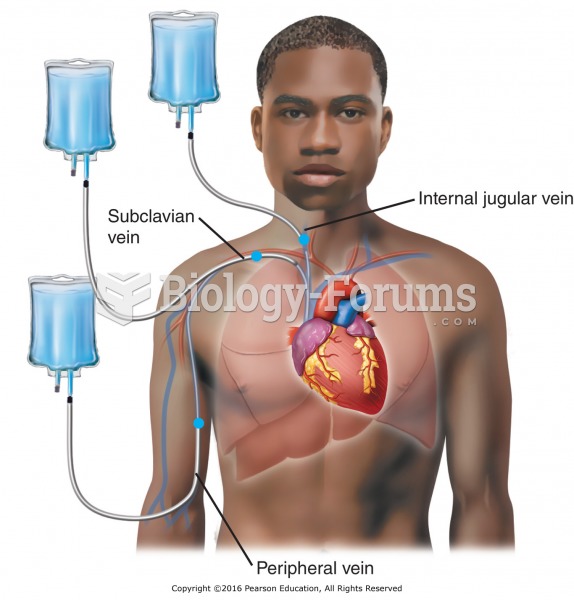 Routes of administration for parenteral nutrition.