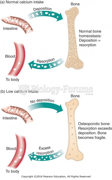 Calcium metabolism in osteoporosis.