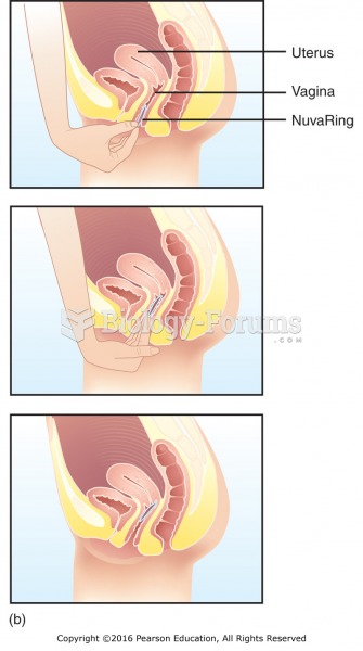Vaginal medication administration: (b) proper insertion of the NuvaRing.