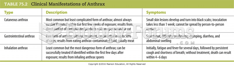 Clinical Manifestations of Anthrax