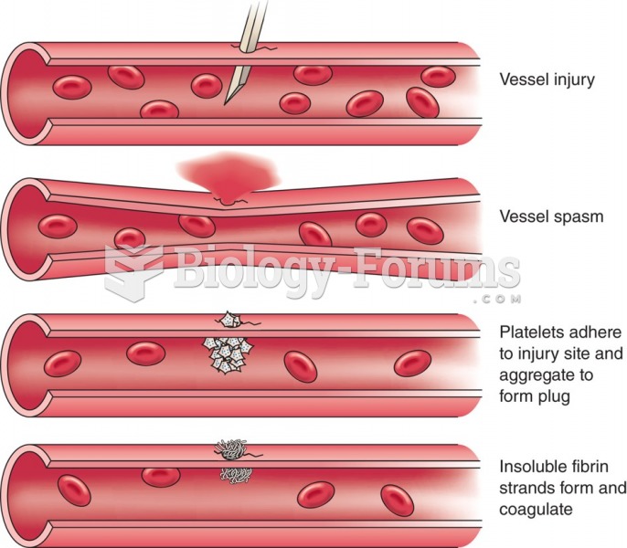 Basic steps in hemostasis.