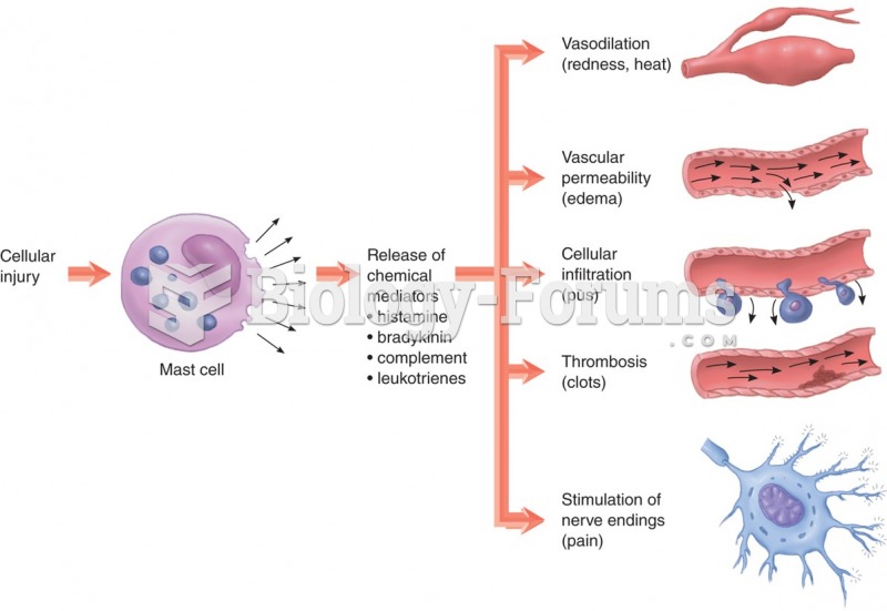 Steps in acute inflammation.