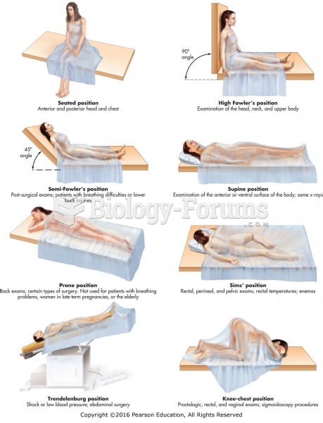Common patient positions.