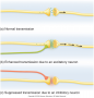 Modification of neural transmission in the central nervous system: (a) normal transmission; (b) ...