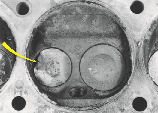 Badly burned exhaust valve. A compression test could have detected a problem, and  a cylinder ...