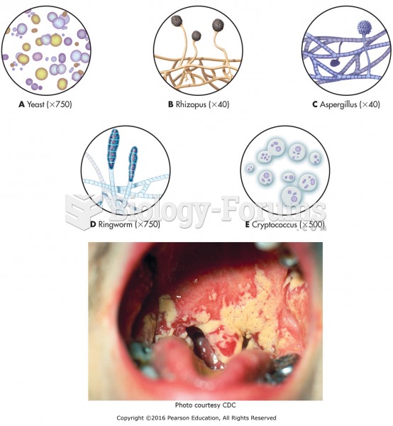 Types of fungi and a fungal infection of the palate.