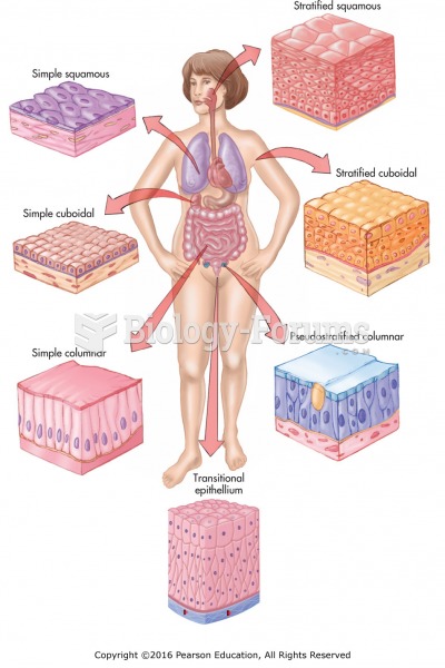 Types and locations of epithelial tissues.