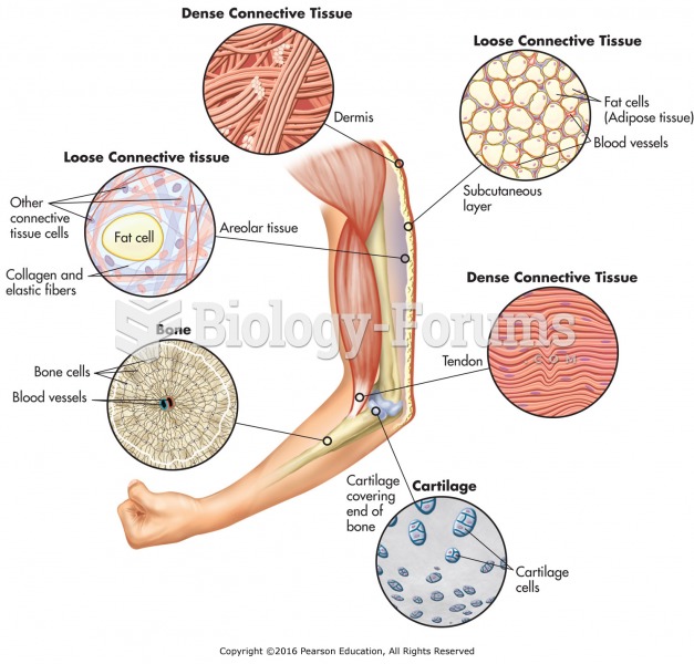Types and locations of connective tissues.