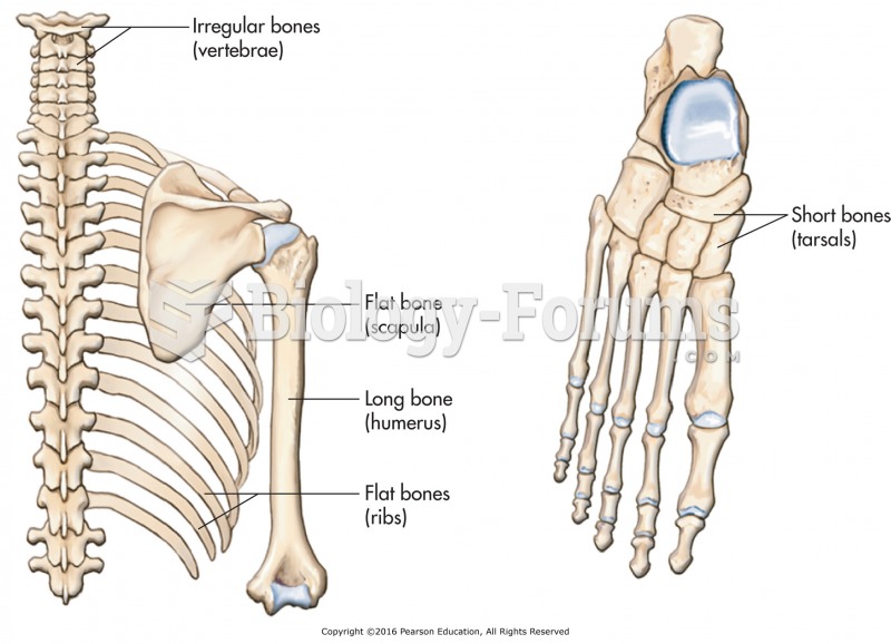 Various bone shapes.