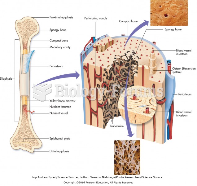 Comparison of compact and spongy bone.