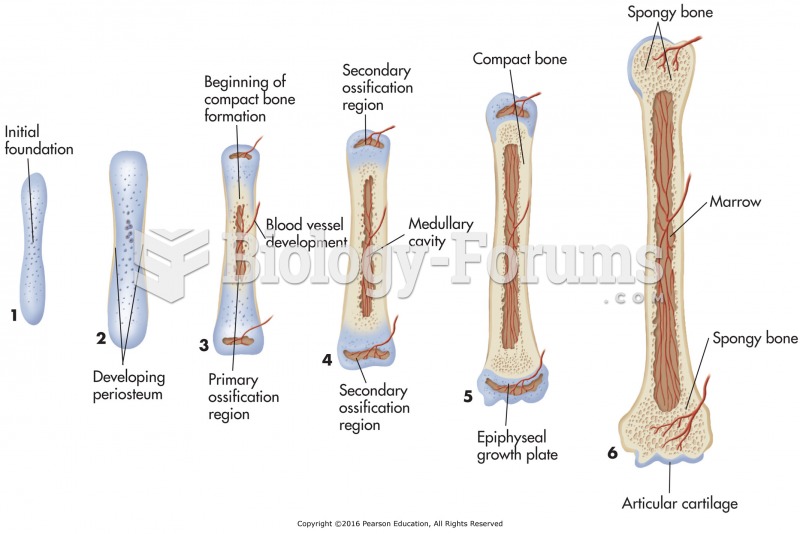 Endochondral ossification of long bone.