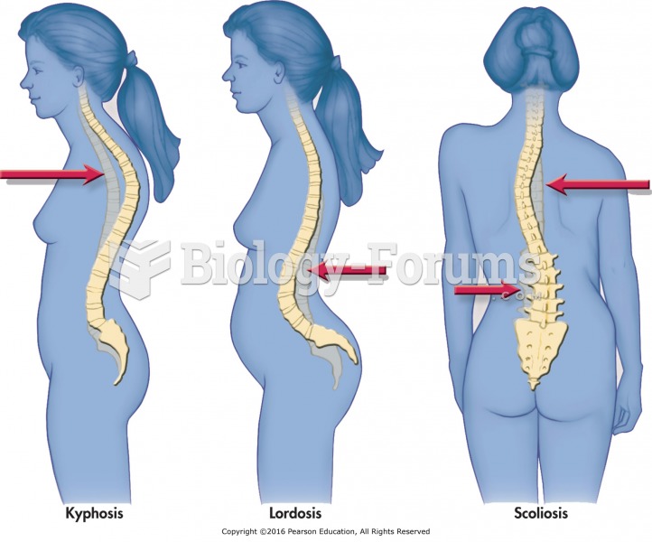 Common spinal disfigurements.