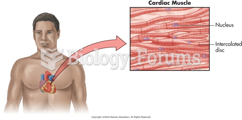 Heart and intercalated discs.