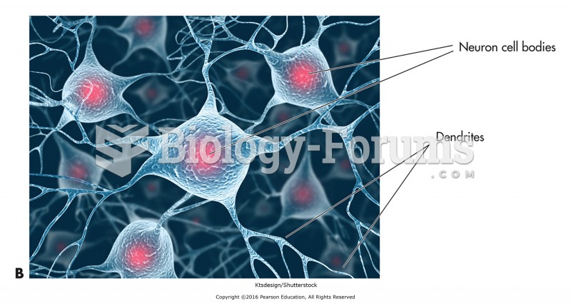 (B) Interneurons or association neurons.