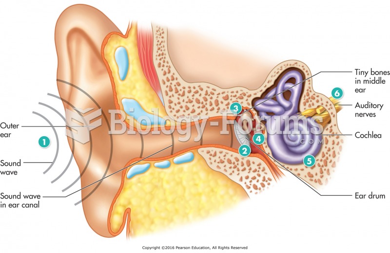 The steps in the hearing process. (1) Sound waves enter the outer ear and travel through the ear ...