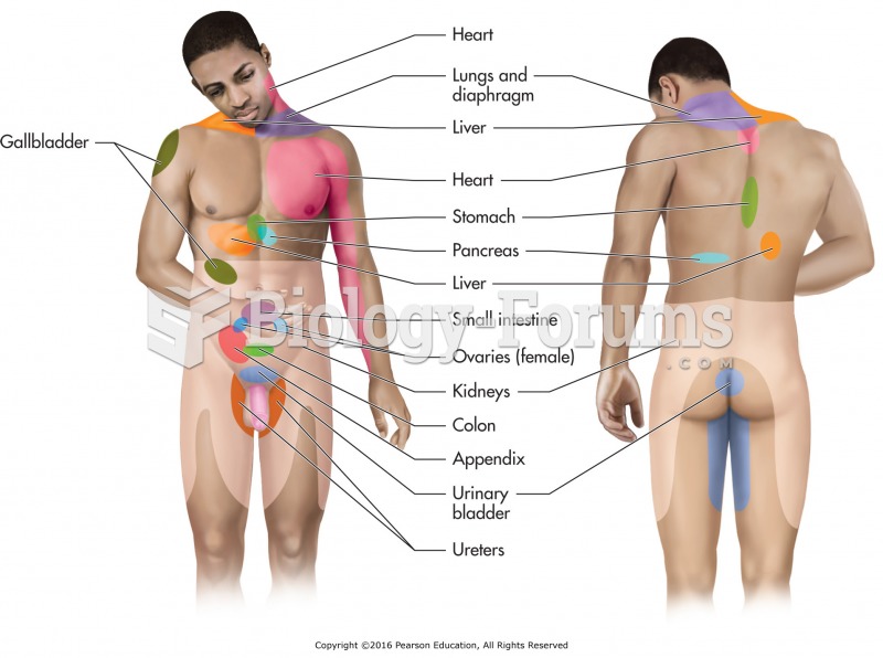 Various sites of referred pain.
