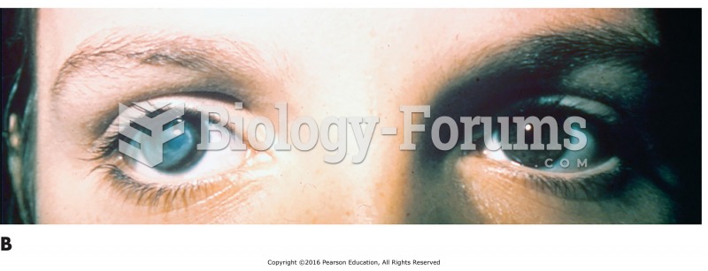 Some common eye disorders. (B) Cataract of right eye. (C) Stye.