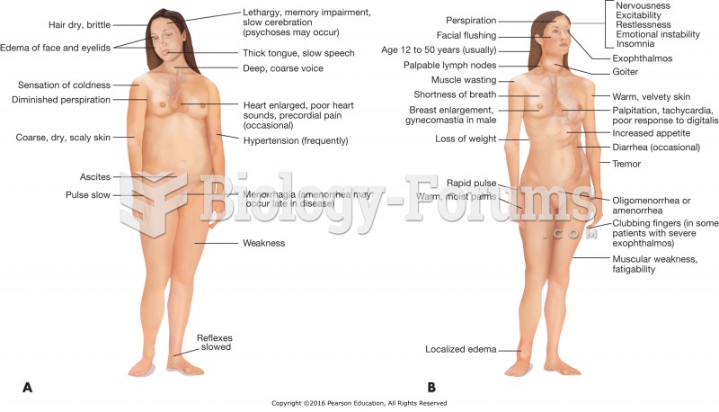 A comparison of the signs and symptoms of (A) hypothyroidism and A comparison of the signs and ...