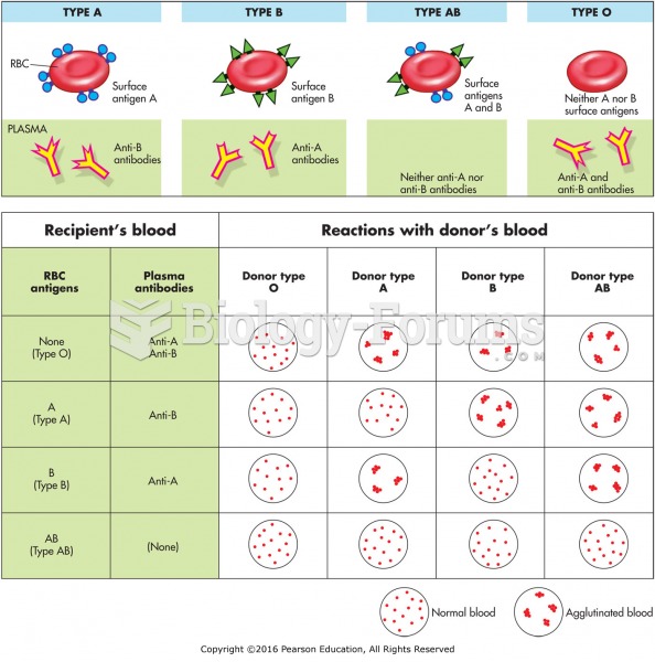 Blood types and results of donor and recipient combinations.