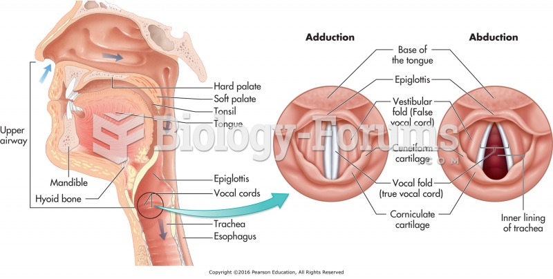 The upper airway and vocal cords.
