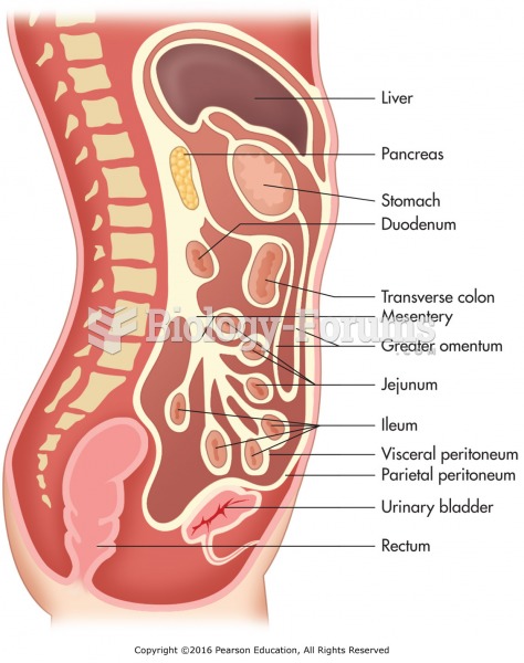 Cross section of peritoneum with related organs and structures.