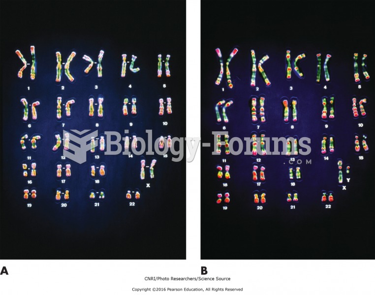 Human chromosomes. (A) Female. (B) Male.