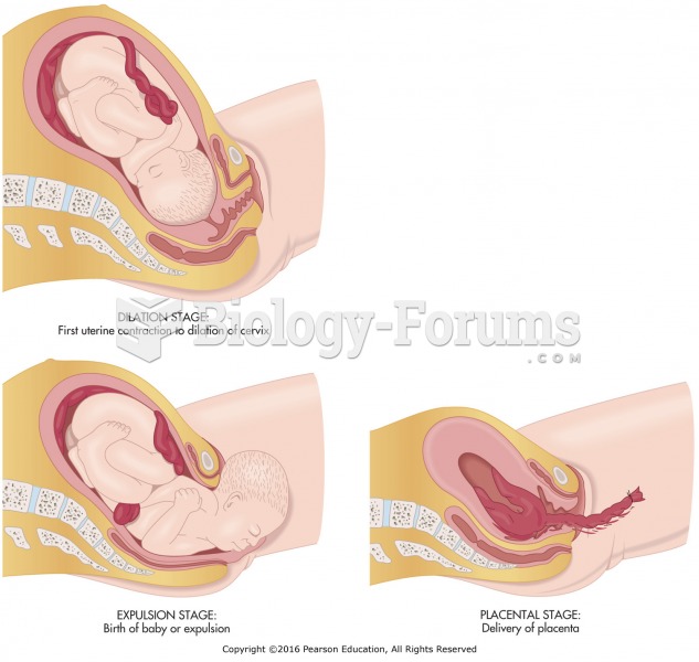 Stages of labor.