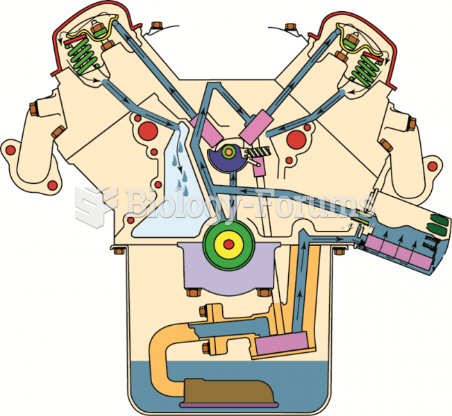 A typical lubrication system, showing  the oil pan, oil pump, oil filter, and oil passages.