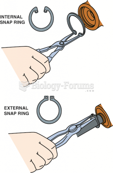 Snap-ring pliers are also called lock-ring pliers, and they are designed to remove internal and ...