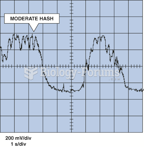 Moderate hash may or may not be significant for diagnosis.