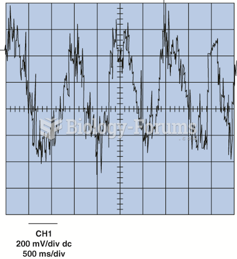 Severe hash is almost always caused  by cylinder misfire conditions.