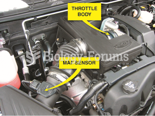 Most air filter housings are located on the side of the engine compartment and use  flexible rubber ...