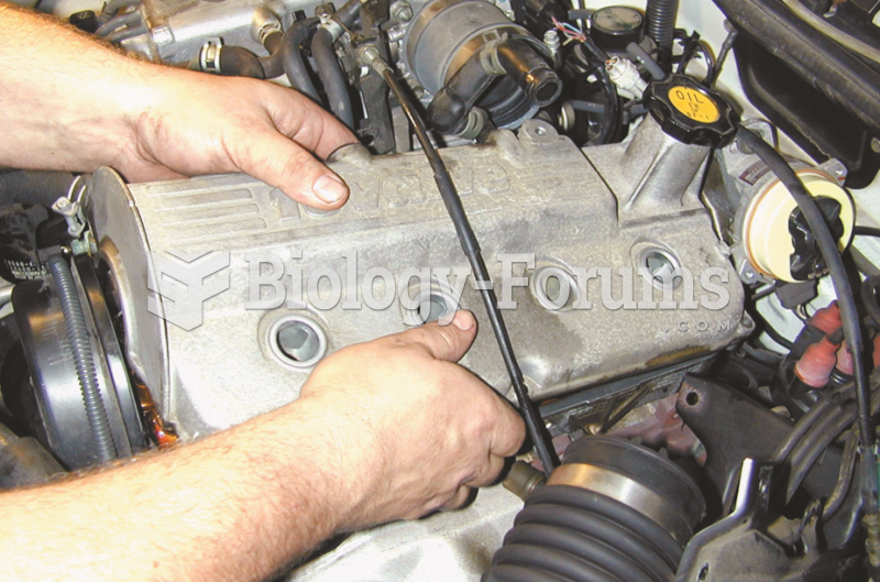 Reinstall the valve cover being careful to not pinch  a wire or vacuum hose between the cover and ...