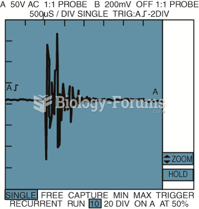 A typical waveform from a knock sensor during a spark knock event. This signal is sent to the ...