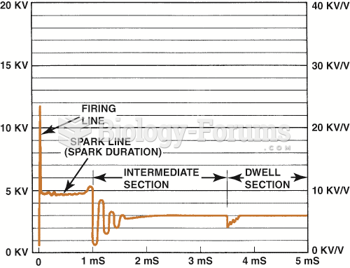 Typical secondary ignition oscilloscope pattern.