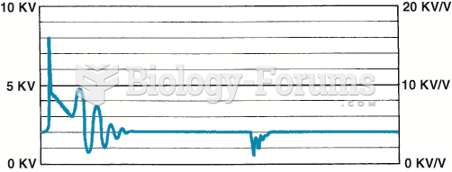 A downward-sloping spark line usually indicates high secondary ignition system resistance or  an ...