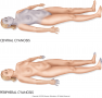 Contrast of central versus peripheral cyanosis.