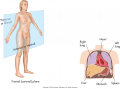 Frontal or coronal plane along with a coronal view of the chest and stomach.