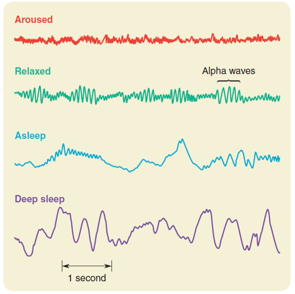 Some typical electroencephalograms and their psychological correlates