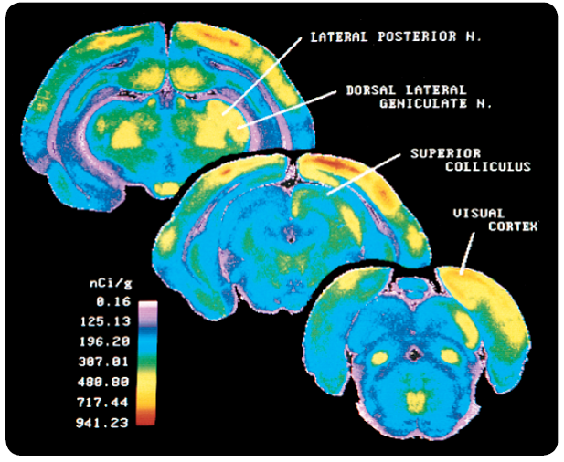 The 2-deoxyglucose technique. The accumulation of radioactivity is shown in three frontal sections ...