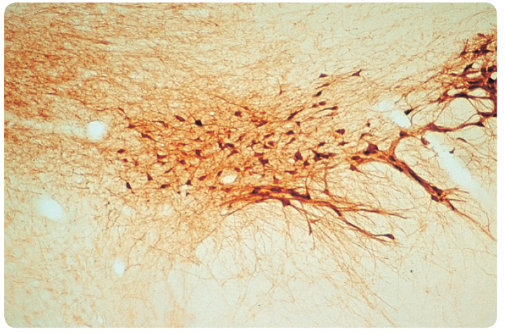 Immunocytochemistry. This section through a rat’s substantia nigra reveals dopaminergic neurons ...