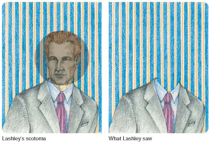 The completion of a migraine-induced scotoma as described by Karl Lashley (1941).