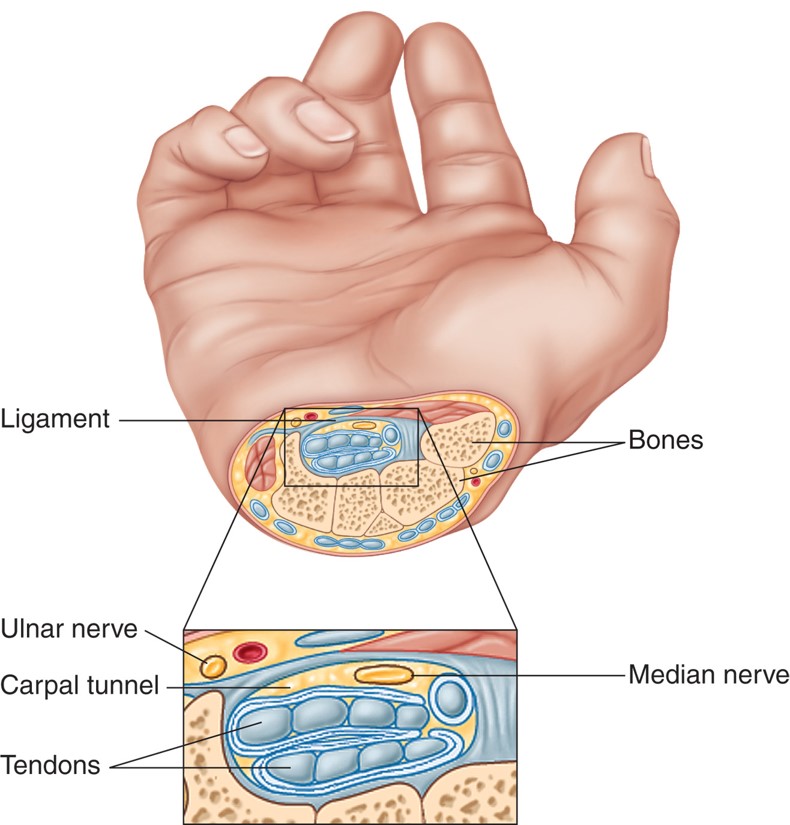 Cross section of the wrist showing tendons and nerves involved in carpal tunnel syndrome.